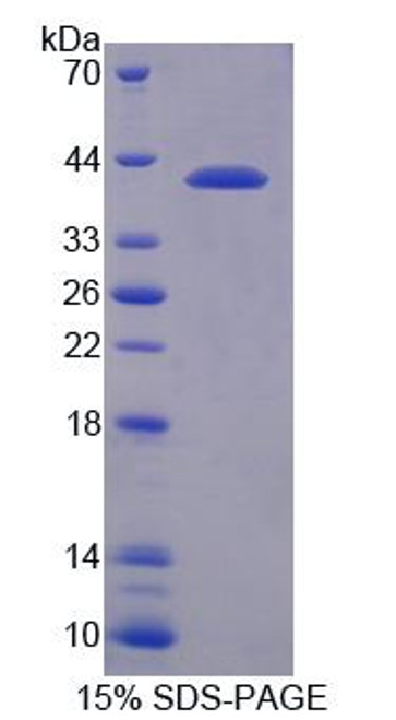 Human Recombinant Nuclear Receptor Corepressor 1 (NCOR1)