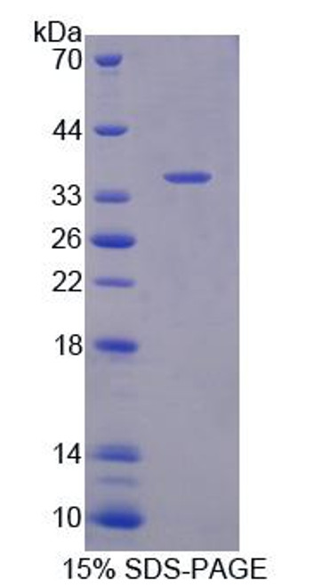 Rat Recombinant Calcyphosine 2 (CAPS2)