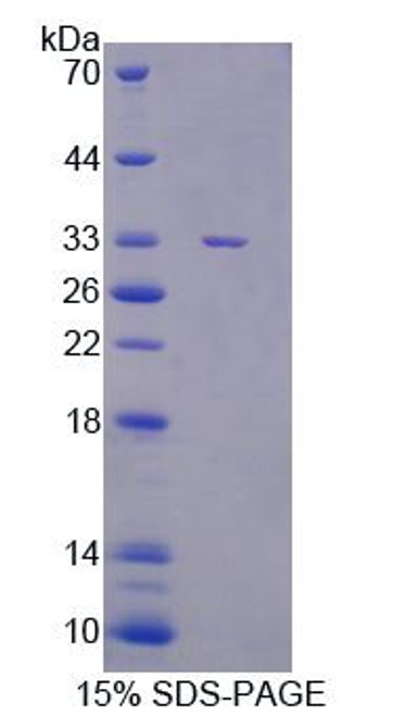 Mouse Recombinant Cancer Susceptibility Candidate 5 (CASC5)