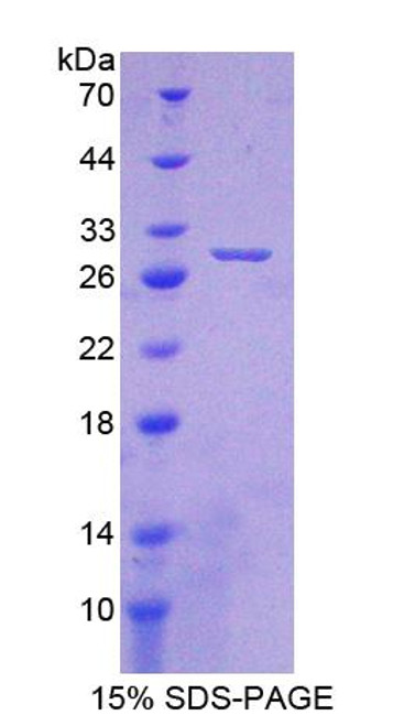 Mouse Recombinant Crystallin Beta A1 (CRYbA1)