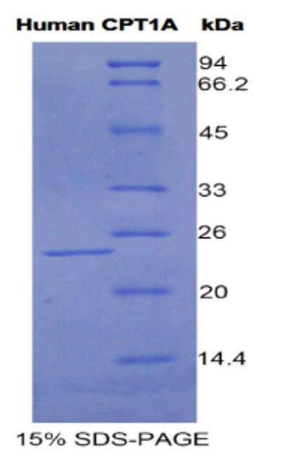 Human Recombinant Carnitine Palmitoyltransferase 1A, Liver (CPT1A)