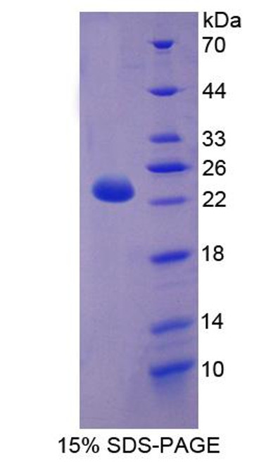 Human Recombinant Carnitine Palmitoyltransferase 1B, Muscle (CPT1B)