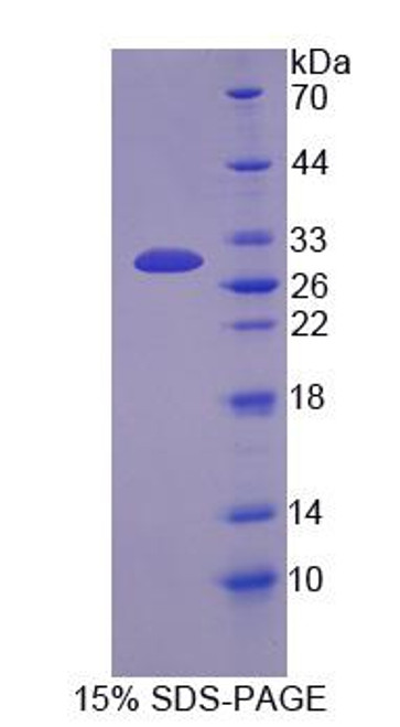 Mouse Recombinant Docking Protein 3 (DOK3)