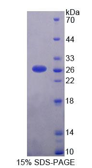 Human Recombinant Calcium Homeostasis Endoplasmic Reticulum Protein (CHERP)