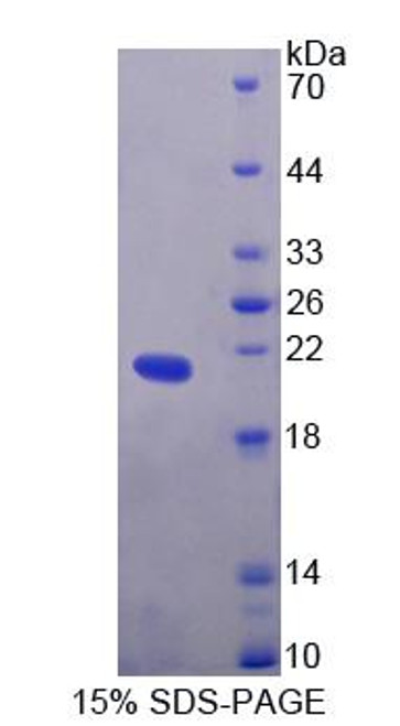 Human Recombinant Endothelin 2 (EDN2)