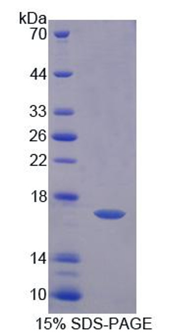 Human Recombinant Fatty Acid Desaturase 3 (FADS3)