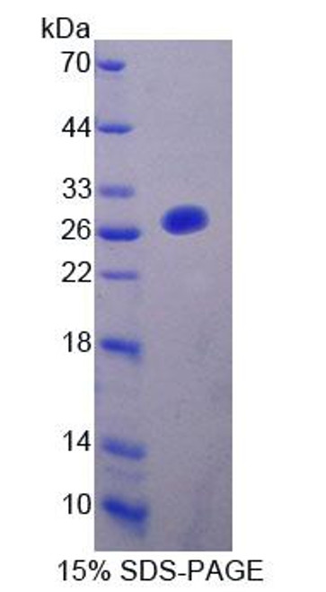 Rat Recombinant Fibulin 7 (FBLN7)