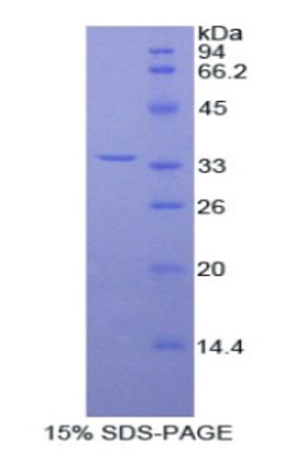 Rat Recombinant Fibulin 3 (FBLN3)