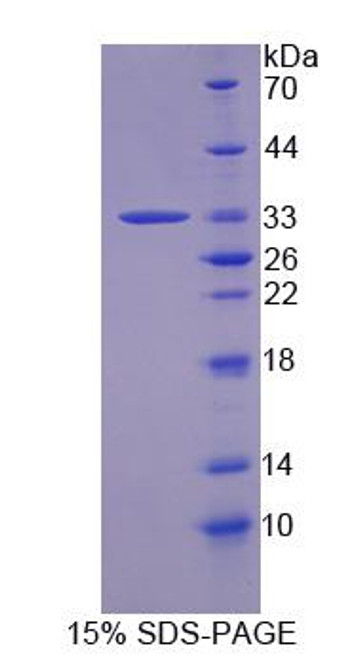 Mouse Recombinant Growth Factor Receptor Bound Protein 14 (Grb14)