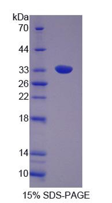 Rat Recombinant Growth Factor Receptor Bound Protein 14 (Grb14)