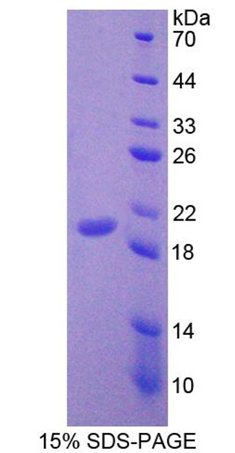 Mouse Recombinant Leukocyte Cell Derived Chemotaxin 2 (LECT2)