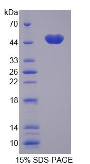 Human Recombinant Lamin A/C (LMNA)