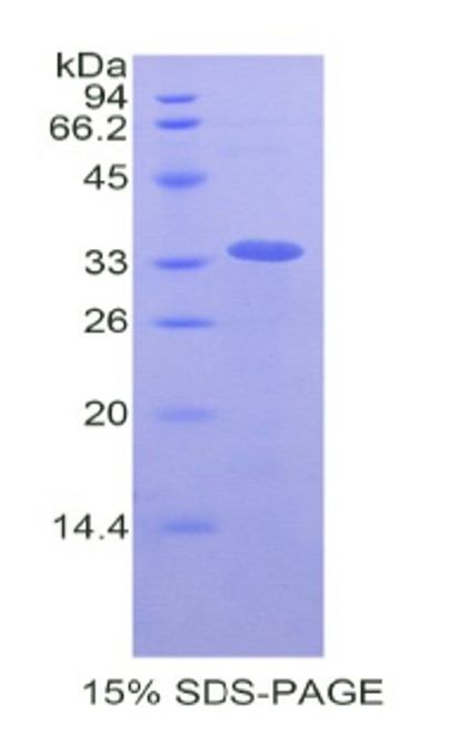 Human Recombinant Lysyl Oxidase Like Protein 4 (LOXL4)