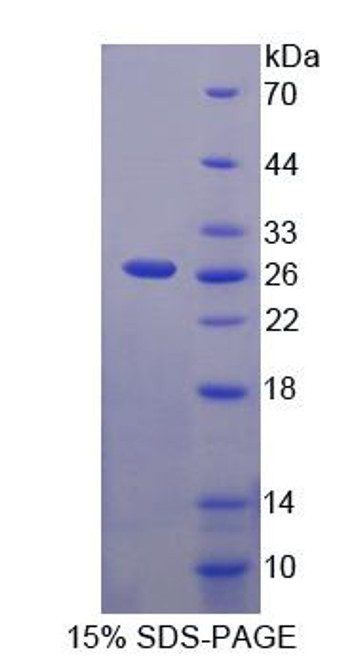 Mouse Recombinant Multimerin 2 (MMRN2)