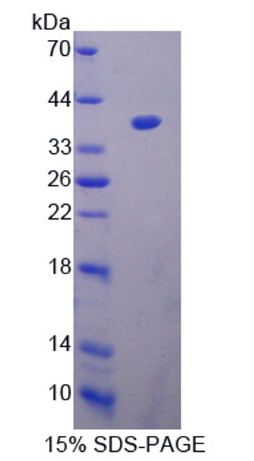 Human Recombinant Peptidyl Arginine Deimina Type III (PADI3)