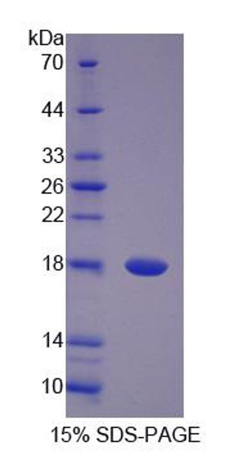 Human Recombinant Pantothenate Kinase 4 (PANK4)