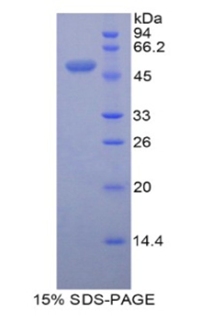 Mouse Recombinant Peroxiredoxin 3 (PRDX3)