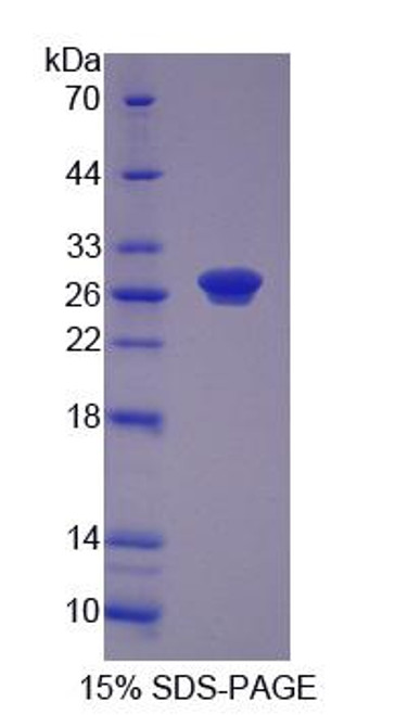 Human Recombinant Ribonucleotide Reductase M1 (RRM1)