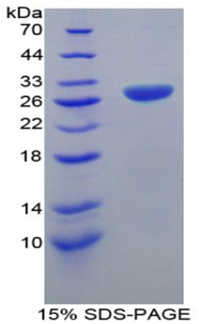 Mouse Recombinant TNF Receptor Associated Factor 1 (TRAF1)