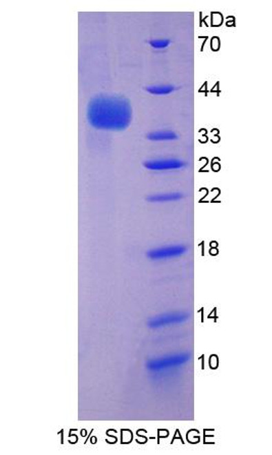 Human Recombinant Adaptor Related Protein Complex 2 Mu 1 (AP2m1)