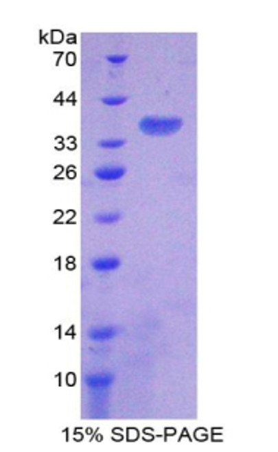 Rat Recombinant ATPase, H+ Transporting, Lysosomal Accessory Protein 2 (ATP6AP2)