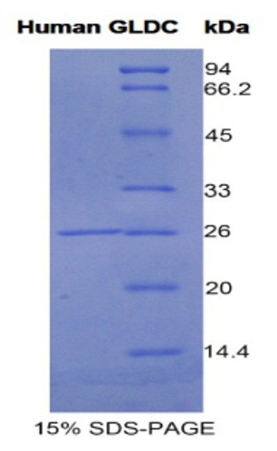 Human Recombinant Glycine Dehydrogenase (GLDC)