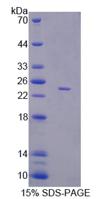 Mouse Recombinant Phosphatidylethanolamine Binding Protein 1 (PEBP1)