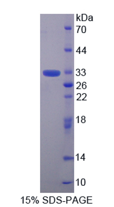 Mouse Recombinant Torsin 1B (TOR1B)