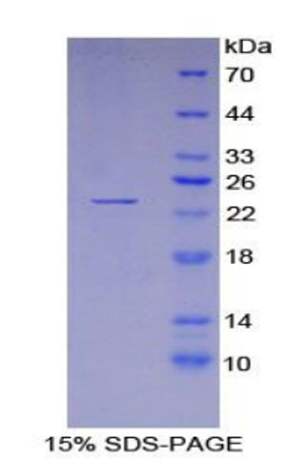 Mouse Recombinant Lens Epithelium Derived Growth Factor (LEDGF)