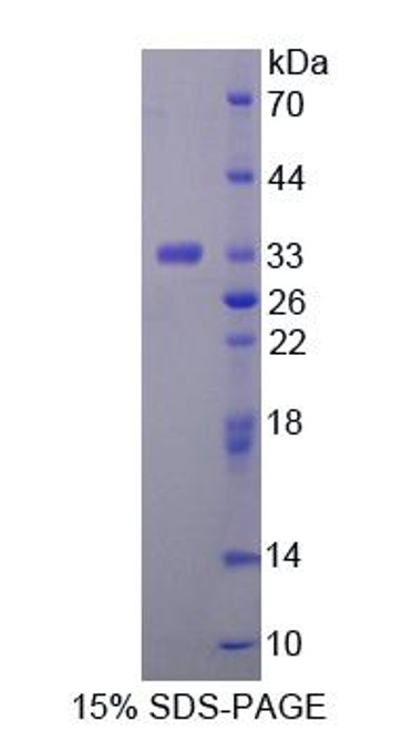 Mouse Recombinant Trehalase (TREH)