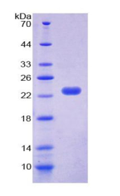 Human Recombinant Cold Inducible RNA Binding Protein (CIRBP)