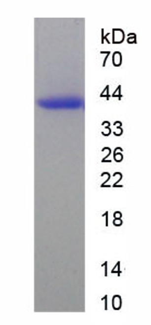 Human Recombinant WNK Lysine Deficient Protein Kinase 1 (WNK1)