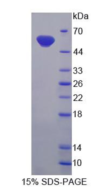 Rat Recombinant UDP Glucuronosyltransferase 2 Family, Polypeptide B7 (UGT2B7)