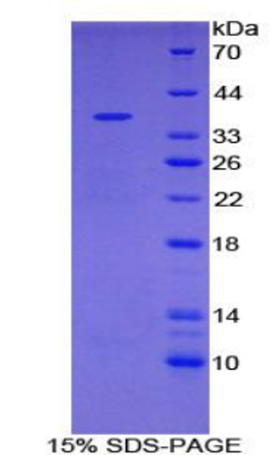 Human Recombinant Ubiquitin Carboxyl Terminal Hydrolase L5 (UCHL5)