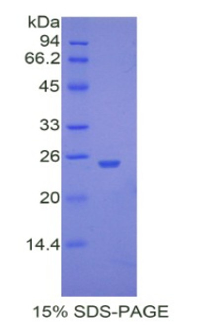 Mouse Recombinant Ubiquitin Carboxyl Terminal Hydrolase L5 (UCHL5)