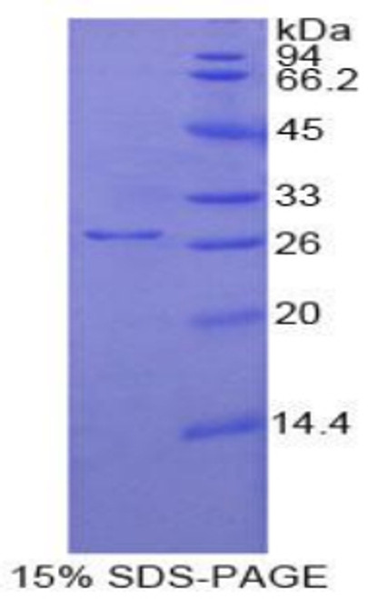 Mouse Recombinant Ubiquitin Carboxyl Terminal Hydrolase L1 (UCHL1)