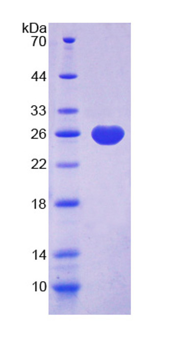 Rat Recombinant Ubiquitin Carboxyl Terminal Hydrolase L1 (UCHL1)