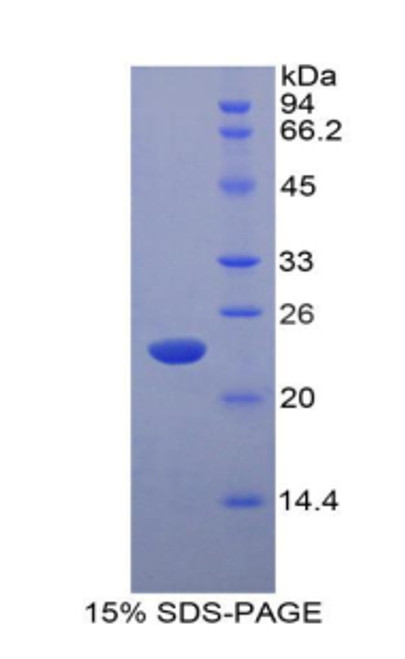 Rat Recombinant Interferon Alpha 5 (IFNa5)