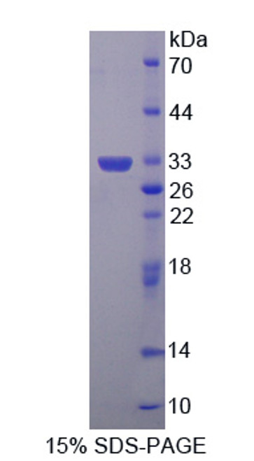 Mouse Recombinant Glutaredoxin 3 (GLRX3)