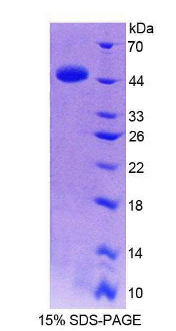 Human Recombinant Thyroid Hormone Receptor Interactor 6 (TRIP6)