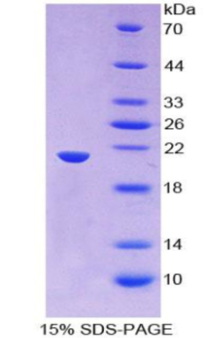 Human Recombinant Thimet Oligopeptidase 1 (THOP1)