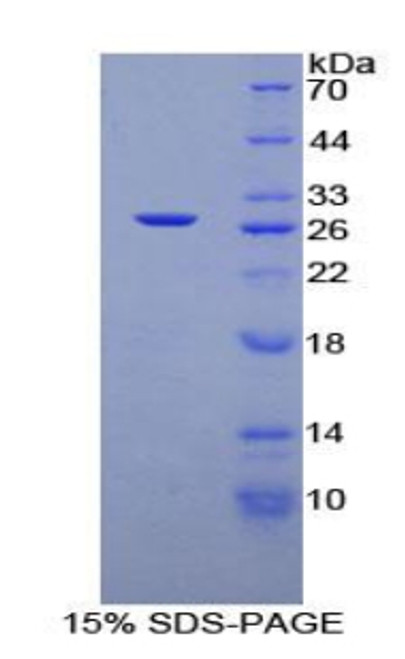 Rat Recombinant Transforming Growth Factor Beta 1 Induced Transcript 1 (TGFb1I1)