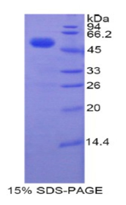 Human Recombinant Transcription Factor A, Mitochondrial (TFAM)