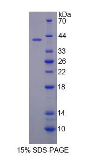 Mouse Recombinant Sulfatase 2 (SULF2)