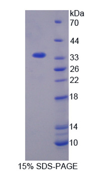 Mouse Recombinant Serine/Threonine Kinase 3 (STK3)