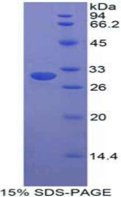 Human Recombinant STAM Binding Protein (STAMBP)