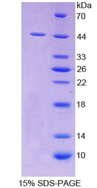 Human Recombinant Scavenger Receptor Class A Member 5 (SCARA5)