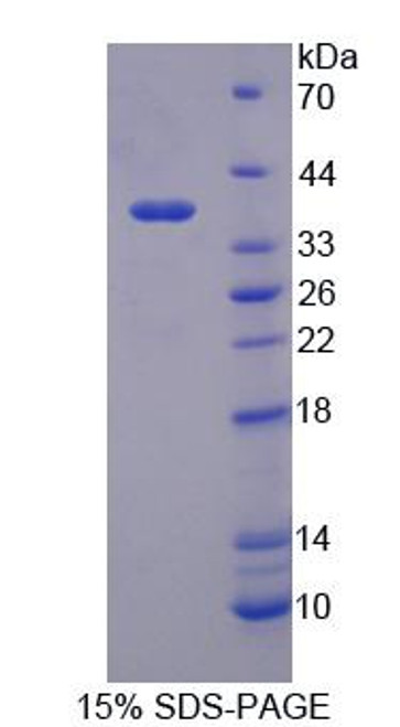 Human Recombinant Pregnancy Specific Beta-1-Glycoprotein 2 (PSG2)