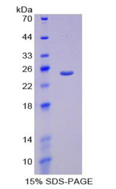 Human Recombinant Peroxisome Proliferator Activated Receptor Gamma Coactivator 1 Alpha (PPARgC1a)