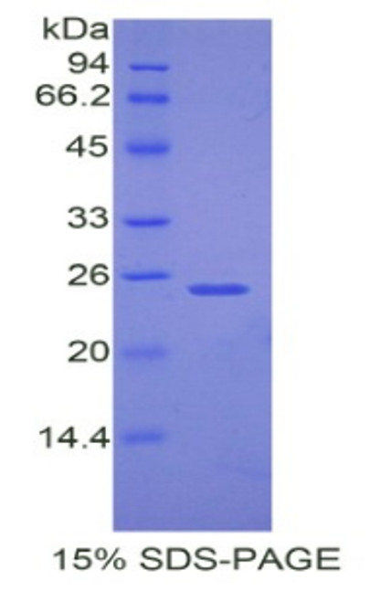 Mouse Recombinant Peroxisome Proliferator Activated Receptor Gamma Coactivator 1 Alpha (PPARgC1a)